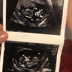 Meet your Posher, Darius